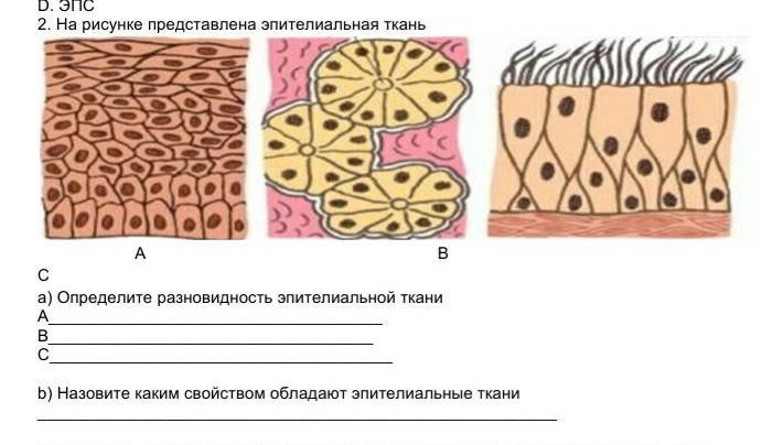 Рассмотри рисунок и ответь на вопрос какие ткани изображены на картинке